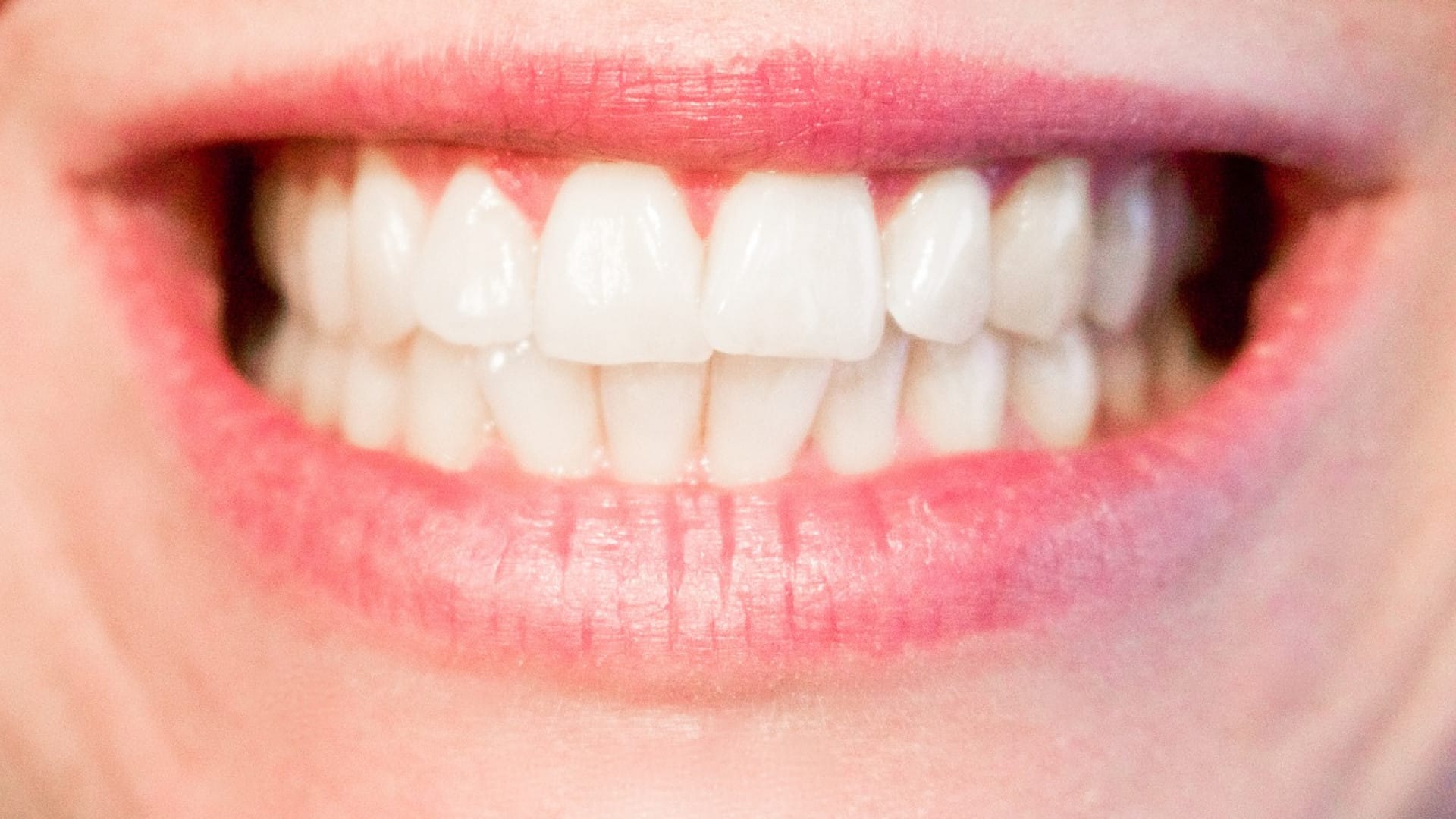 N’ayez plus peur de sourire grâce à l’implant dentaire