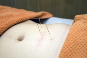 acupuncture regles