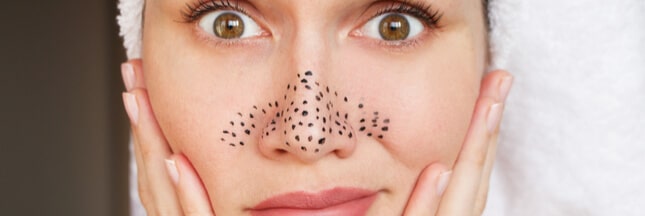 soin visage point noir acne - Comment se débarrasser des points noirs?