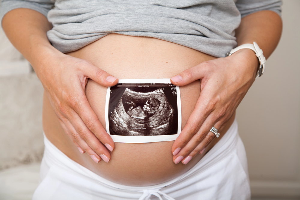 Femme enceinte tenant une échographie, symbole de suivi prénatal et lien parental