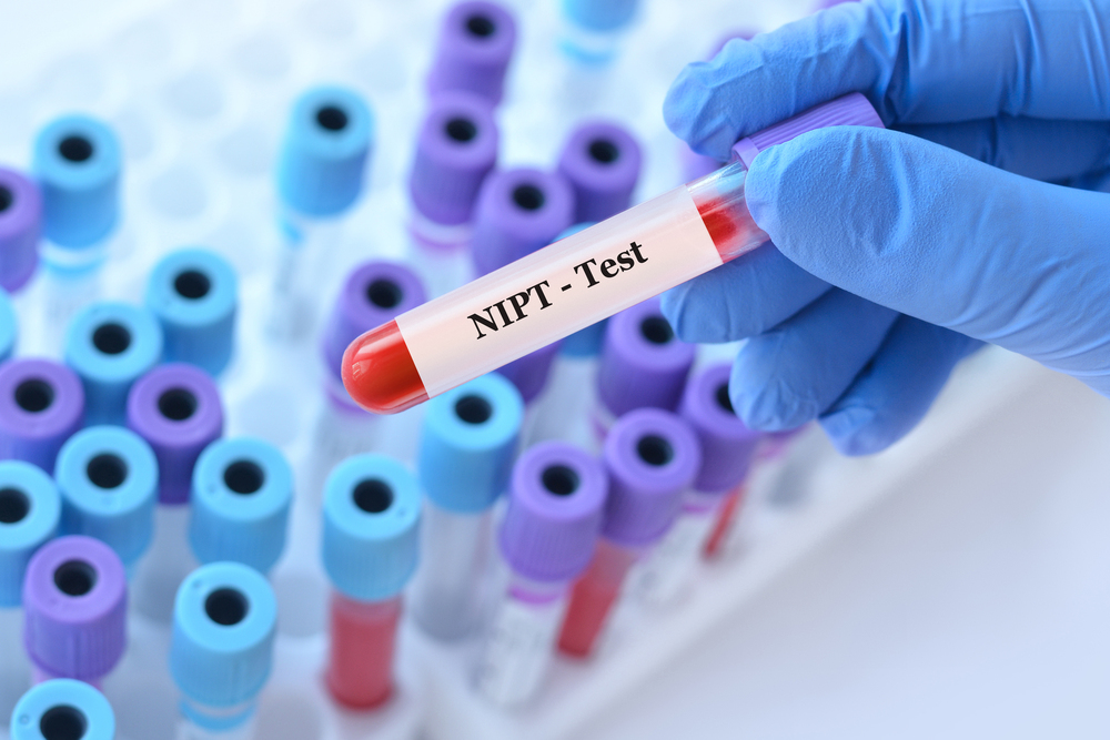 Échantillon de sang pour test VIH, dépistage médical essentiel en début de grossesse