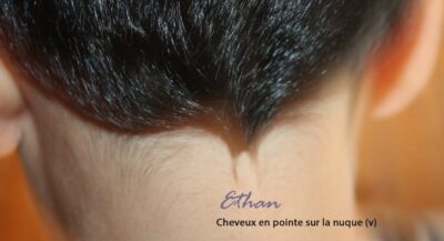 Cheveux en pointe sur la nuque