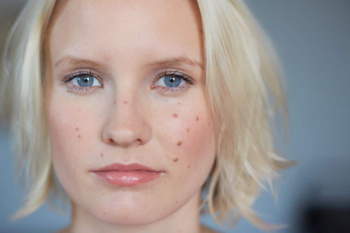 taches soins visage femme - Avoir une peau lumineuse grâce à un soin du visage anti taches