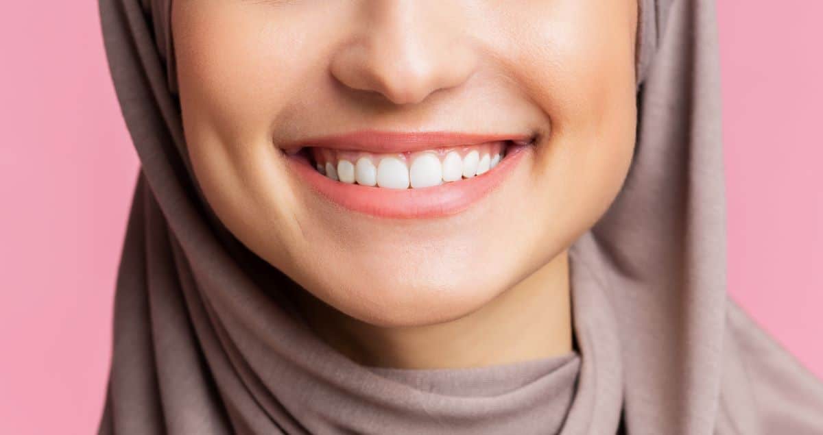 belles dents blanches femme - Comment aligner les dents? La méthode Impress