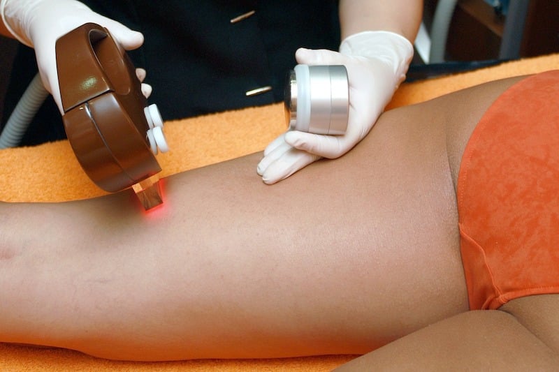 Épilation laser : tout ce qu’il faut savoir !