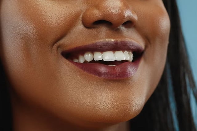 Jeune-femme-aux-dents-blanche