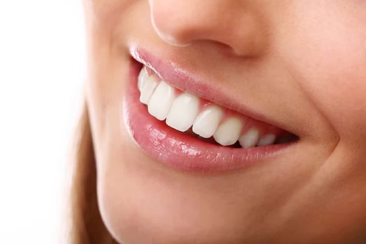 Obtenir des dents blanches : Conseils pour un sourire éclatant !