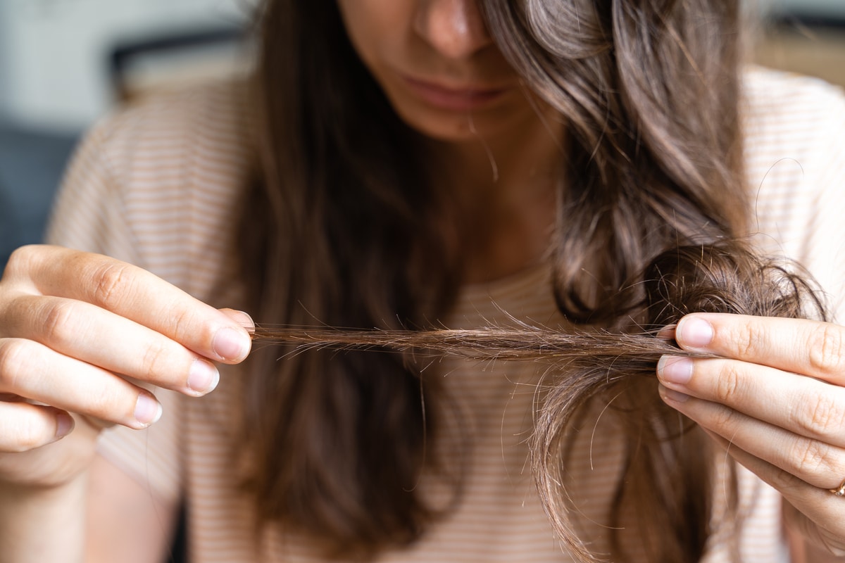 la jeune femme a un problème de perte de cheveux. perdre les cheveux après une maladie covid. shampooing de soin pour réparer les cheveux fins. avitaminose, problème d'anémie