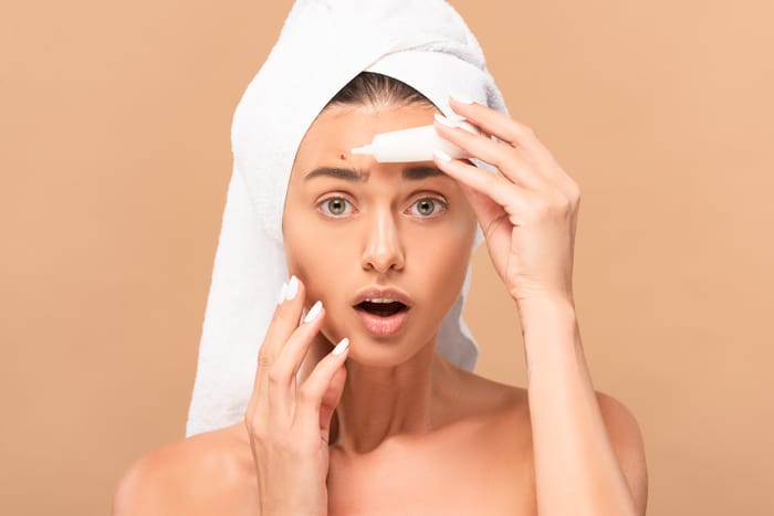 femme choquée et nue dans une serviette tenant une crème de traitement près d'un bouton sur le visage isolée sur beige