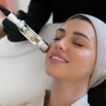 L’Hydrafacial : votre allié beauté pour une peau éclatante