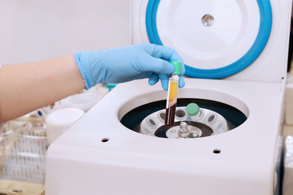 technique PRP
