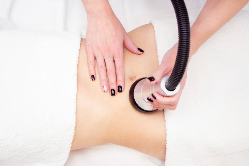 Un traitement en institut sur le ventre dune femme avec de la cellulite