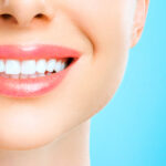 Avoir un plus beau sourire : Nos conseils pour des dents parfaitement alignées