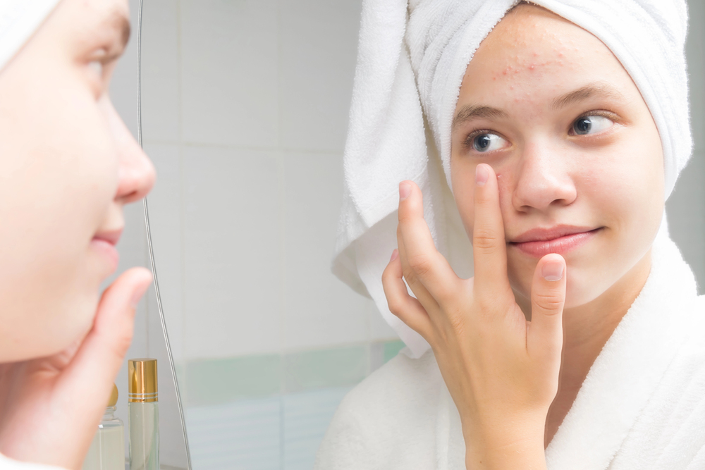 Jeune fille devant le miroir avec une serviette sur la tête appliquant une crème sur son visage avec une peau légèrement grasse et quelques imperfections