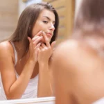 Comment lutter contre les imperfections de peau après l’adolescence ?