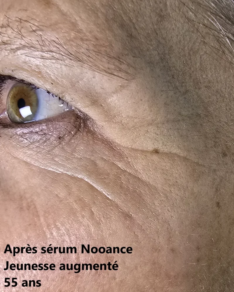 Femme d'une soixantaine d'années photographiée après utilisation du sérum Nooance Jeunesse Augmentée